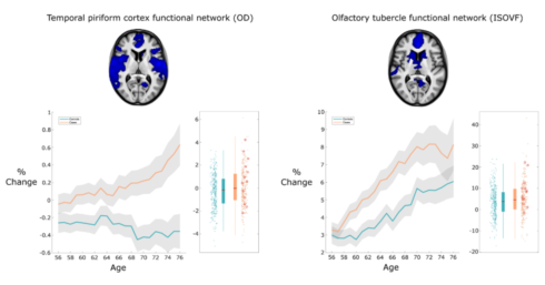 COVID and the Brain