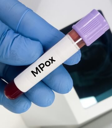 Monkeypox Washington Post Op-Ed