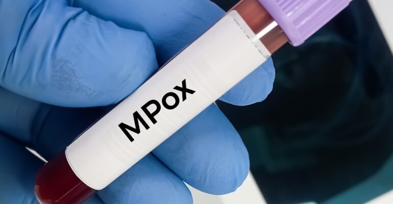 Monkeypox Washington Post Op-Ed